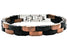 Blackjack Jewelry Two Tone Black and Chocolate SS Bracelet - Time After Time Watches